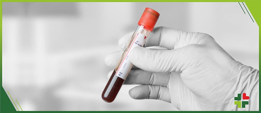 Top 10 Reasons Why You Should Regularly Go for Blood Tests