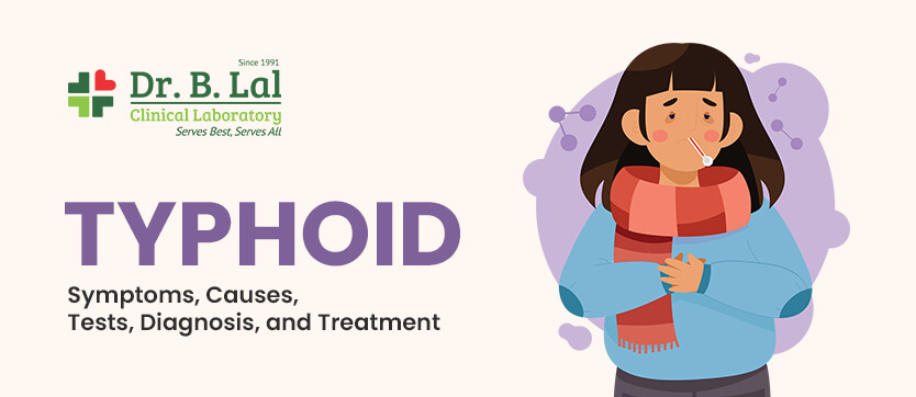 Typhoid – Symptoms, Causes, Diagnosis, Test, & Treatment | Dr. B. Lal Lab Blog