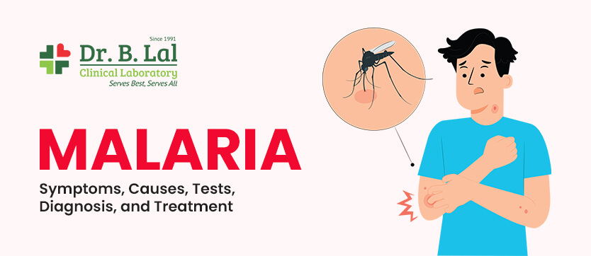 Malaria – Symptoms, Causes, Tests & Treatment | Dr. B. Lal Lab Blog