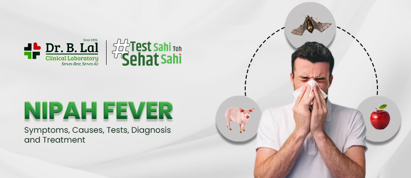 Nipah Virus: Symptoms, Transmission,   Diagnosis and Treatment