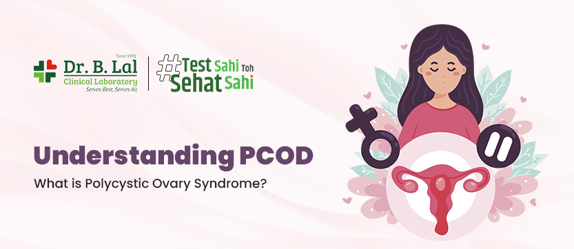 Understanding PCOD: What is Polycystic Ovary Syndrome?
