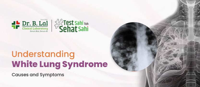Understanding White Lung Syndrome: Causes and Symptoms 