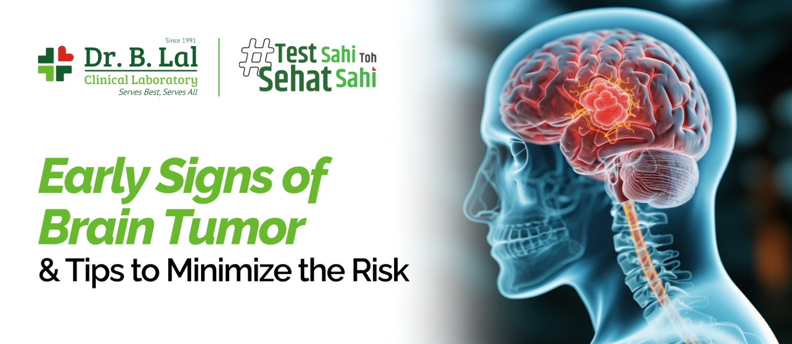 Early Signs of Brain Tumor & Tips to Minimize the Risk