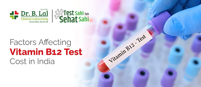 Factors Affecting Vitamin B12 Test Cost in India