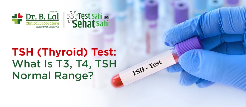 TSH (Thyroid) Test: What is Normal Range of T3, T4, TSH?