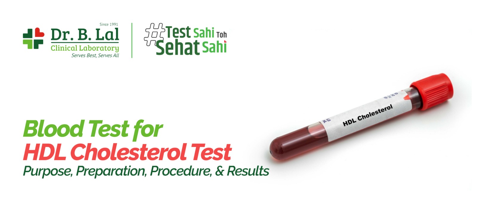 Blood Test for HDL Cholesterol: Purpose, Preparation, Procedure, & Results