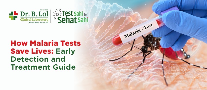 How Malaria Tests Save Lives: Early Detection and Treatment Guide