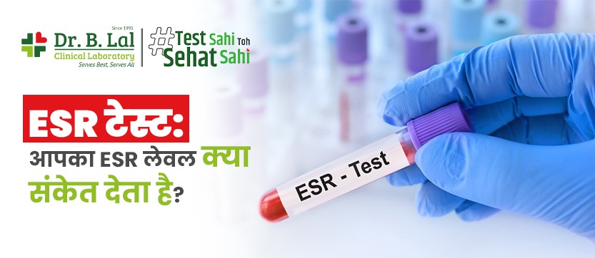 ESR टेस्ट: आपका ESR लेवल क्या संकेत देता है?