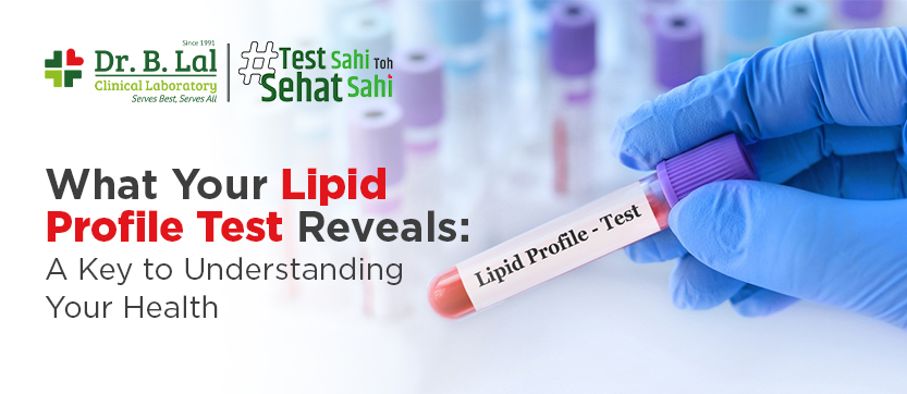 What Your Lipid Profile Test Reveals: A Key To Understanding Your Health