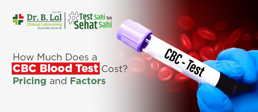 How Much Does a CBC Blood Test Cost? Pricing and Factors