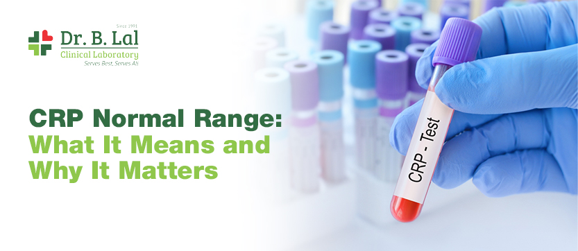 CRP Normal Range: What It Means And Why It Matters