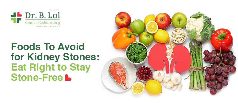 Foods to Avoid for Kidney Stones: Eat Right to Stay Stone-Free