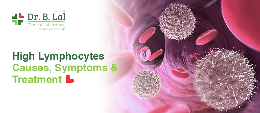 High Lymphocytes Causes, Symptoms & Treatment