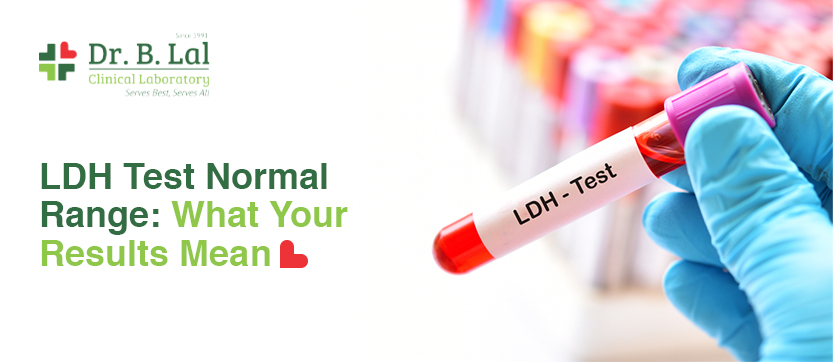 LDH Test Normal Range: What Your Results Mean