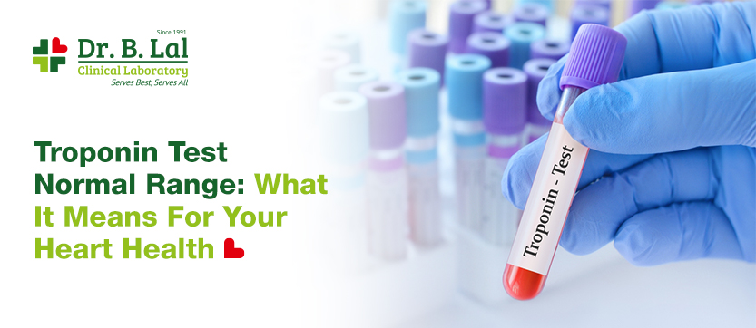 Troponin Test Normal Range: What It Means For Your Heart Health